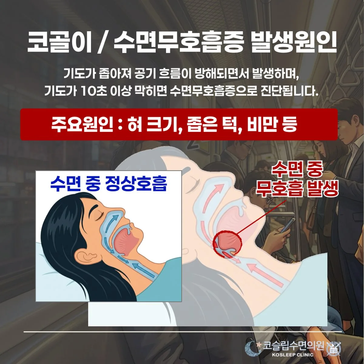 코골이와 수면무호흡이 생기는 원인을 설명하는 클리닉 안내 카드